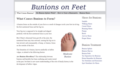 bunionsonfeet.org