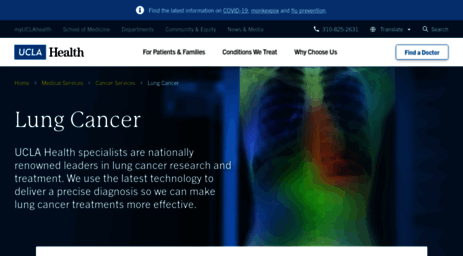 lungcancer.ucla.edu