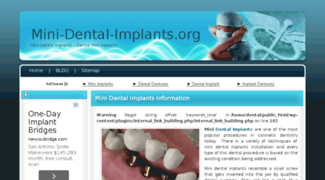 mini-dental-implants.org