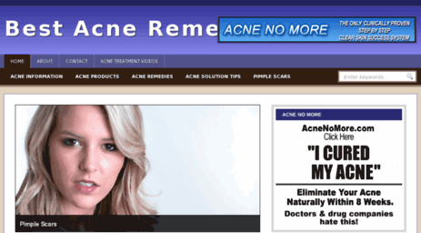 naturalacne-remedy.info
