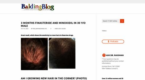 baldingblog.com