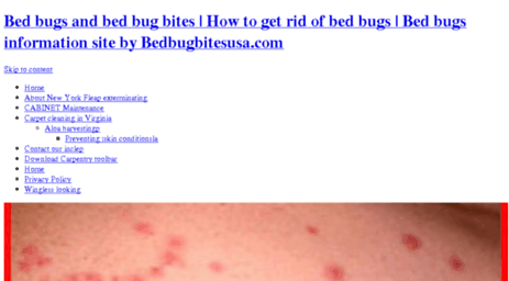 bedbugbitesusa.com